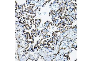 Immunohistochemistry of paraffin-embedded rat lung using  Rabbit pAb (ABIN3016739, ABIN3016740, ABIN3016741, ABIN1678526 and ABIN6219830) at dilution of 1:100 (40x lens). (Angiotensin I Converting Enzyme 1 Antikörper  (AA 30-270))