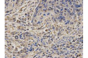 Immunohistochemistry (IHC) image for anti-Succinate Dehydrogenase Complex, Subunit A, Flavoprotein (Fp) (SDHA) antibody (ABIN1874712)