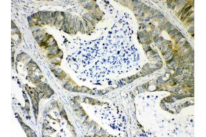 Immunohistochemistry (IHC) image for anti-Aldo-Keto Reductase Family 1, Member B10 (Aldose Reductase) (AKR1B10) (AA 285-316), (C-Term) antibody (ABIN5518800)