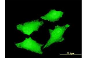 Immunofluorescence of monoclonal antibody to CDC45L on HeLa cell. (CDC45 Antikörper  (AA 1-566))