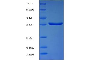SDS-PAGE (SDS) image for Protein Phosphatase, Mg2+/Mn2+ Dependent, 1B (PPM1B) (AA 2-193) protein (His-SUMO Tag) (ABIN5710135)