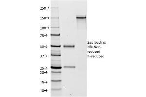 SDS-PAGE Analysis Purified Kappa Light Chain Mouse Monoclonal Antibody (KLC264). (IGKC Antikörper)