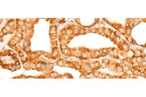 Immunohistochemistry (Paraffin-embedded Sections) (IHC (p)) image for anti-Zinc Finger, MYND-Type Containing 10 (ZMYND10) antibody (ABIN7252297)