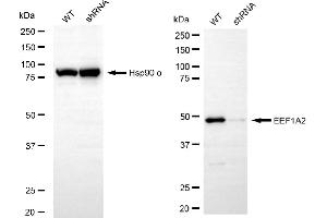 anti-Eukaryotic Translation Elongation Factor 1 alpha 2 (EEF1A2) antibody