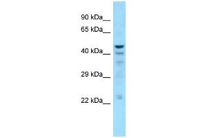 WB Suggested Anti-NT5C Antibody Titration: 1. (NT5C Antikörper  (C-Term))