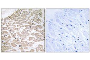 Immunohistochemistry analysis of paraffin-embedded human heart tissue using RAD antibody. (RRAD Antikörper  (Internal Region))