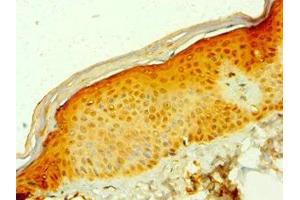 Immunohistochemistry of paraffin-embedded human skin tissue using ABIN7158940 at dilution of 1:100 (MDH1 Antikörper  (AA 1-334))