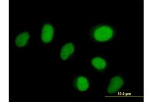 Immunofluorescence of purified MaxPab antibody to ZNF792 on HeLa cell. (ZNF792 Antikörper  (AA 1-553))