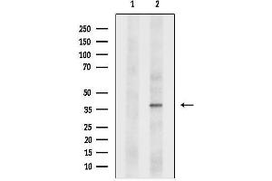 Western blot analysis of lysates from Myeloma cells, using AM Antibody.