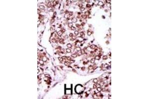 Immunohistochemistry (IHC) image for anti-Calcium/calmodulin-Dependent Protein Kinase II gamma (CAMK2G) antibody (ABIN2995254)