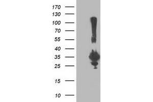 Western Blotting (WB) image for anti-Phenylethanolamine N-Methyltransferase (PNMT) antibody (ABIN1500311) (PNMT Antikörper)