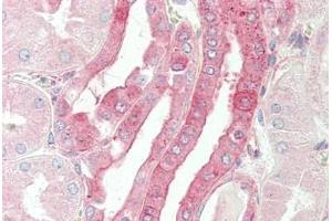 Human Kidney: Formalin-Fixed, Paraffin-Embedded (FFPE) (CELF3 Antikörper  (AA 3-32))