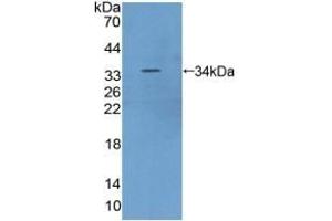 Detection of Recombinant FRAP, Human using Polyclonal Antibody to Serine/threonine-protein kinase mTOR (mTOR) (MTOR Antikörper  (AA 2226-2488))