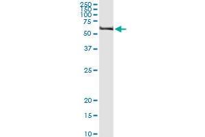 Immunoprecipitation of TRIM62 transfected lysate using anti-TRIM62 MaxPab rabbit polyclonal antibody and Protein A Magnetic Bead , and immunoblotted with TRIM62 purified MaxPab mouse polyclonal antibody (B01P) . (TRIM62 Antikörper  (AA 1-475))