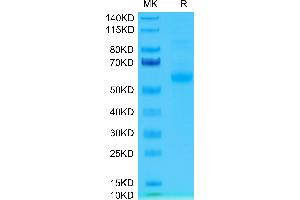 SDS-PAGE (SDS) image for Sialic Acid Binding Ig-Like Lectin 15 (SIGLEC15) (AA 24-260) protein (Fc Tag) (ABIN7275593)