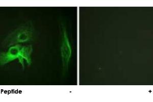 Immunofluorescence analysis of HeLa cells, using PAK1 polyclonal antibody . (PAK1 Antikörper)