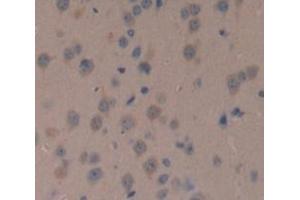 Immunohistochemistry (IHC) image for anti-Nephroblastoma Overexpressed (NOV) (AA 150-354) antibody (ABIN5013996)