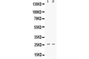 Western blot analysis of PF4 expression in 293T whole cell lysates ( Lane 1) and A549 whole cell lysates ( Lane 2). (PF4 Antikörper  (AA 32-101))