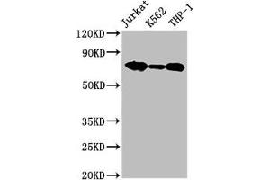 Western Blot Positive WB detected in: Jurkat whole cell lysate, K562 whole cell lysate, THP-1 whole cell lysate All lanes: LCP1 antibody at 2. (LCP1 Antikörper  (AA 2-627))