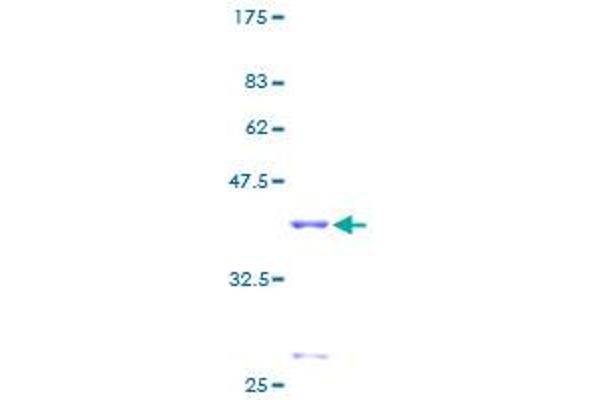 SPEG Protein (AA 1-113) (GST tag)