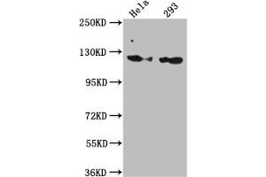 Western Blot Positive WB detected in: Hela whole cell lysate, 293 whole cell lysate All lanes: RNF20 antibody at 1:1000 Secondary Goat polyclonal to rabbit IgG at 1/50000 dilution Predicted band size: 114 kDa Observed band size: 114 kDa (Rekombinanter RNF2 Antikörper)