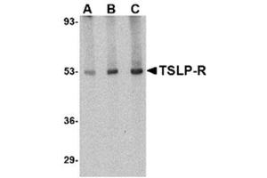 Image no. 2 for anti-Cytokine Receptor-Like Factor 2 (CRLF2) (Middle Region) antibody (ABIN318884) (CRLF2 Antikörper  (Middle Region))