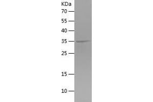 TBC1D5 Protein (AA 496-795) (His tag)