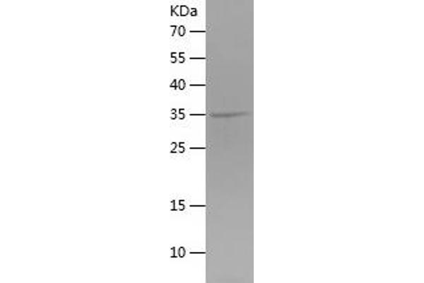 TBC1D5 Protein (AA 496-795) (His tag)