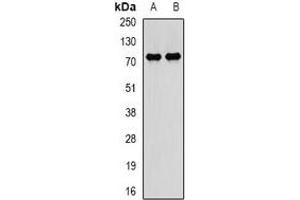 Western blot analysis of PADI4 expression in BT474 (A), SKOV3 (B) whole cell lysates. (PAD4 Antikörper)