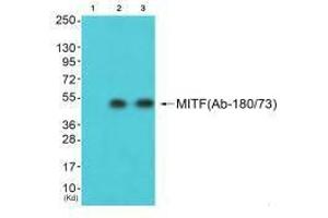 Western blot analysis of extracts from HepG2 cells (Lane 2) and 3T3 cells (Lane 3), using MITF (Ab-180/73) antiobdy. (MITF Antikörper  (Ser73, Ser180))