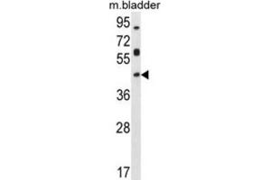 Western Blotting (WB) image for anti-Homeobox D13 (HOXD13) antibody (ABIN2996088) (Homeobox D13 Antikörper)