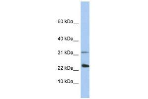 EXOSC3 antibody used at 1 ug/ml to detect target protein. (EXOSC3 Antikörper  (C-Term))