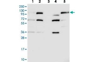 Western blot analysis of Lane 1: RT-4, Lane 2: U-251 MG, Lane 3: Human Plasma, Lane 4: Liver, Lane 5: Tonsil with FILIP1L polyclonal antibody . (FIL1L Antikörper)