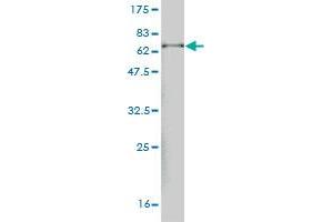 Western Blotting (WB) image for anti-Wings Apart-Like Protein Homolog (WAPAL) (AA 1-402) antibody (ABIN524949)