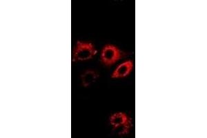 Immunofluorescent analysis of ALDH4A1 staining in A549 cells. (ALDH4A1 Antikörper)
