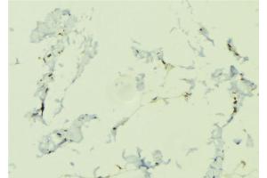 ABIN6276645 at 1/100 staining Human lung tissue by IHC-P. (NOD1 Antikörper  (C-Term))
