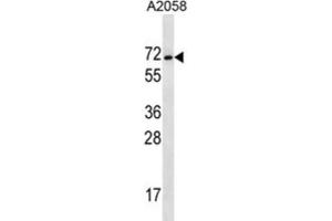 Western Blotting (WB) image for anti-Melanoma Antigen Family E, 2 (MAGEE2) antibody (ABIN2997193) (MAGEE2 Antikörper)