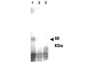 Western blot using MER2 (phospho S30) polyclonal antibody  shows detection of phos-phorylated MER2, but not phosphatase treated or mutant cells. (CD151 Antikörper  (pSer30))