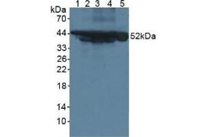 Western blot analysis of (1) Mouse Serum, (2) Mouse Intestine Tissue, (3) Mouse Pancreas Tissue, (4) Mouse Liver Tissue and (5) Human HeLa cells. (Cytokeratin 18 Antikörper  (AA 1-423))