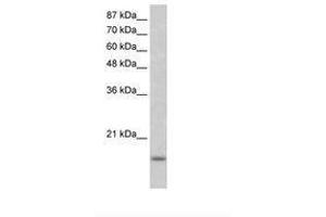 Image no. 1 for anti-Inhibitor of DNA Binding 3, Dominant Negative Helix-Loop-Helix Protein (ID3) (N-Term) antibody (ABIN202020)
