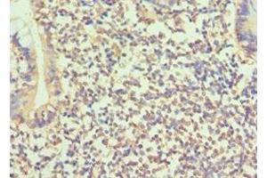 Immunohistochemistry of paraffin-embedded human small intestine tissue using ABIN7145683 at dilution of 1:100 (BMP15 Antikörper  (AA 143-392))