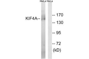 Western blot analysis of extracts from HeLa cells, using KIF4A antibody. (KIF4A Antikörper  (C-Term))