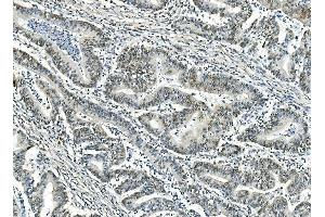 IHC analysis of ATF1 using anti-ATF1 antibody (ABIN7599192). (AFT1 Antikörper  (AA 1-271))