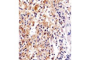 Immunohistochemical analysis of paraffin-embedded H. (FCER1G Antikörper  (C-Term))
