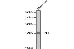 JAK1 Antikörper  (AA 120-380)