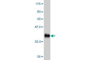 Western Blot detection against Immunogen (36. (ACVRL1 Antikörper  (AA 22-119))