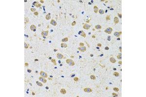 Immunohistochemistry of paraffin-embedded rat brain using EPHA2 Antibody. (EPH Receptor A2 Antikörper  (AA 847-976))