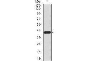 Western blot analysis using KDM4A mAb against human KDM4A (AA: 932-1057) recombinant protein.