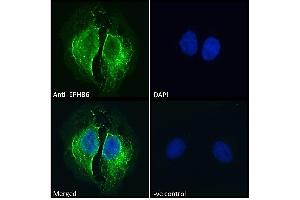 ABIN7013872 Immunofluorescence analysis of paraformaldehyde fixed U2OS cells, permeabilized with 0. (EPH Receptor B6 Antikörper  (Internal Region))