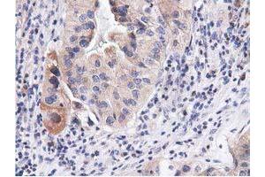 Image no. 10 for anti-COBW Domain Containing 1 (CBWD1) antibody (ABIN1497117) (CBWD1 Antikörper)